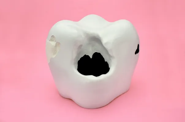 「予防歯科」で健康な歯を守る